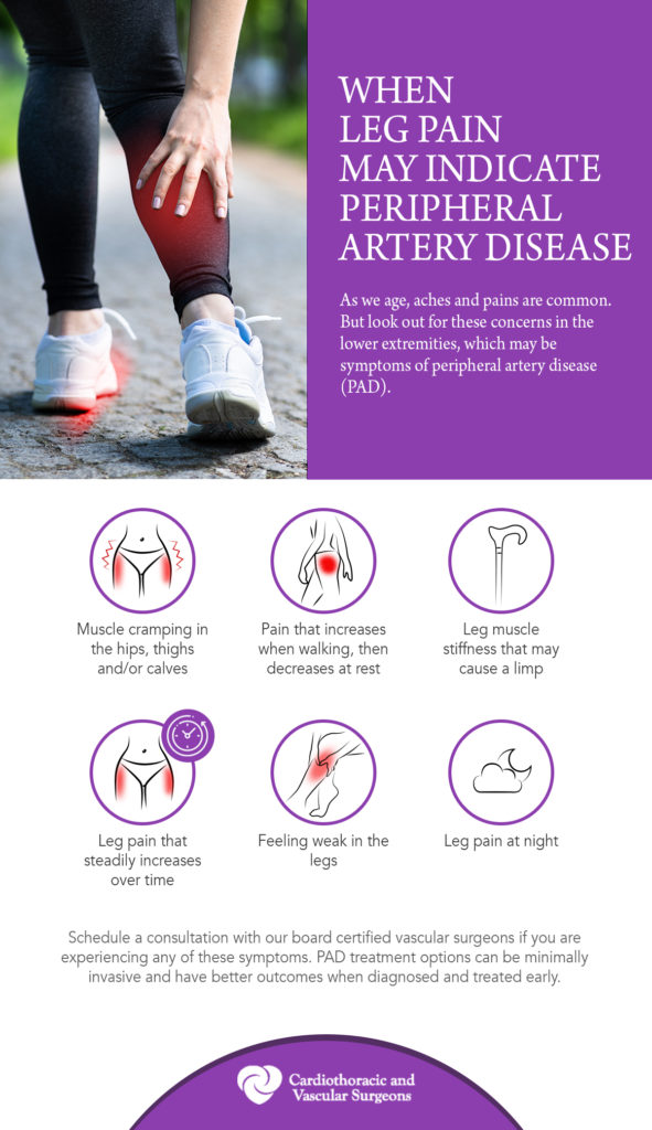 CTVS-Leg Pain Infographic