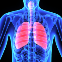 What is Spontaneous Pneumothorax?