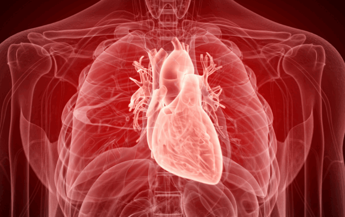 heart disease