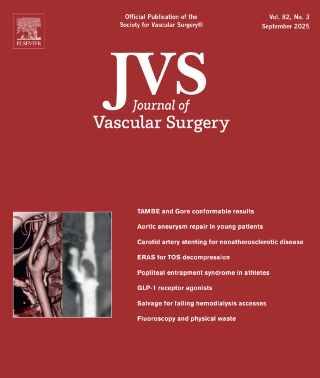 Journal of Vascular Surgery